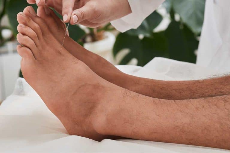 point acupuncture pied 1